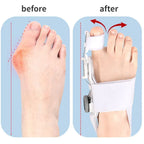 Bunion Corrector Toe Separator