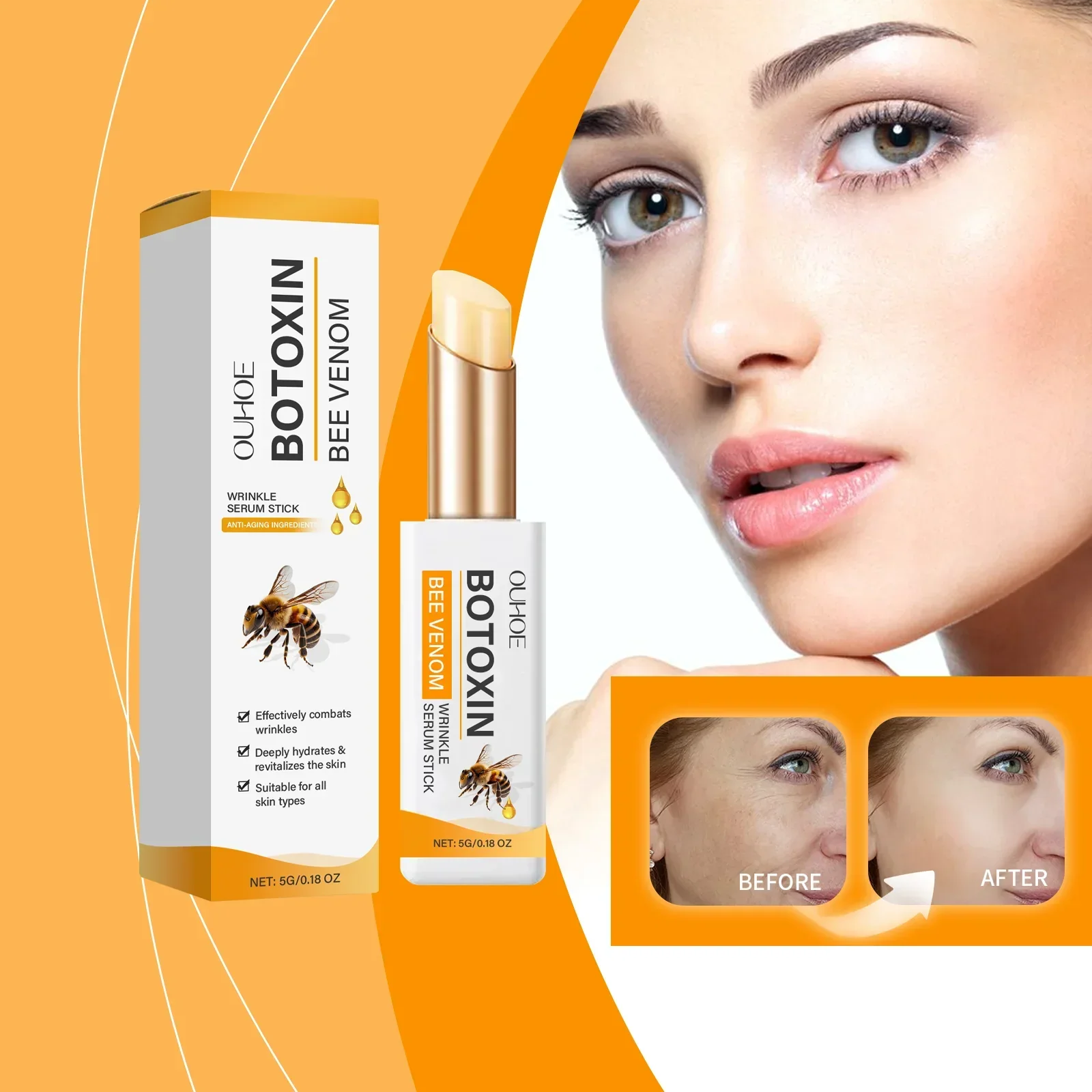 Eye Ointment Treatment