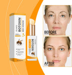 Eye Ointment Treatment