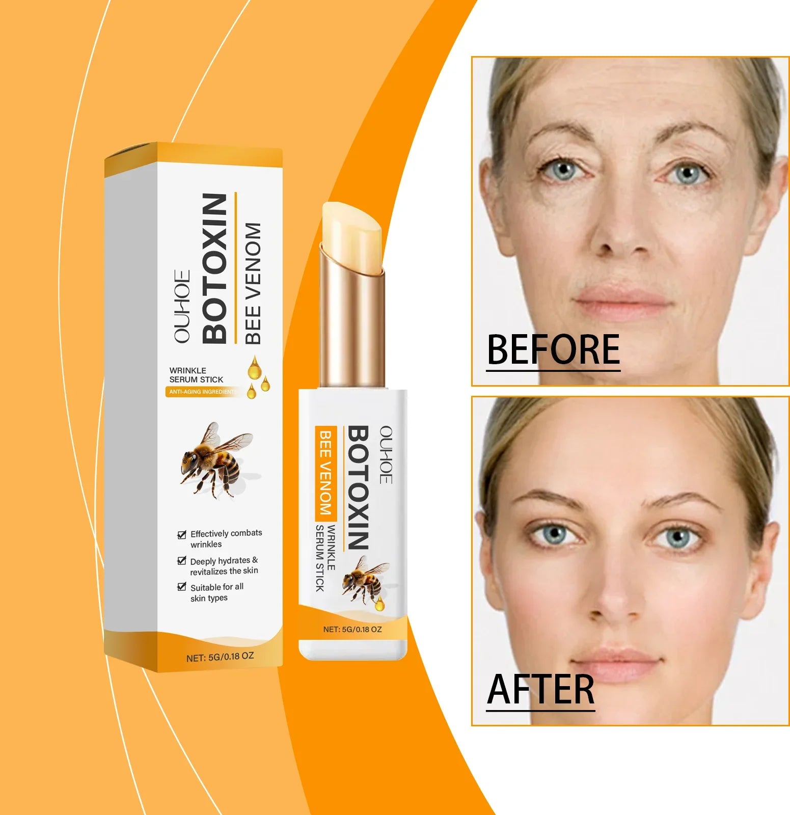 Eye Ointment Treatment